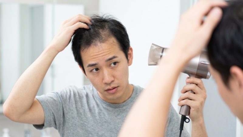 鏡越しに生え際の状態を細かく観察する男性。AGAの初期症状を早期に発見し、適切な対策を検討するための日常的な光景。