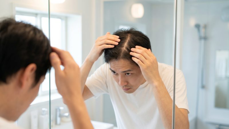鏡を利用して頭頂部のボリュームを確認する男性。AGAの進行度を把握し、最適な治療法を検討するステップ。