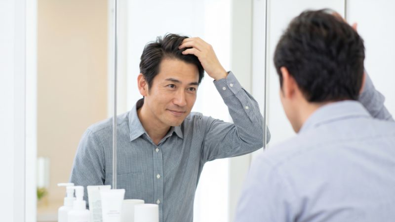 AGA治療後の経過を鏡で確認する男性。治療を継続することで発毛を実感し、自信に満ちた表情を見せている。