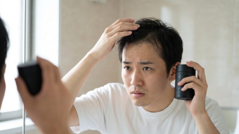 発毛剤を手に、鏡で生え際の状態をチェックする男性。AGA治療の効果を最大化するための、正しいヘアケアの実践。