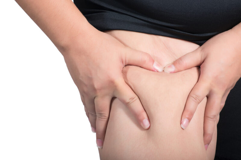 気になる太ももの皮下脂肪を両手でつまみ、厚さを確認してダイエットを意識する様子。