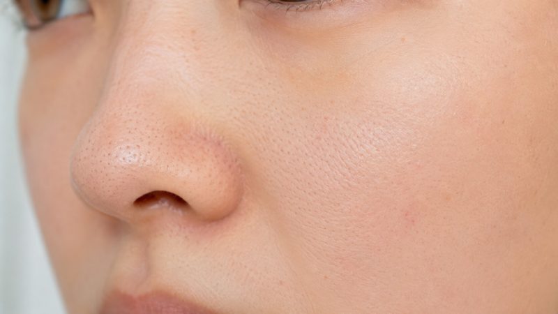 ニキビが気になる方におすすめのサプリ比較！種類別の原因や対策、Q&Aも紹介 | キレイ百科