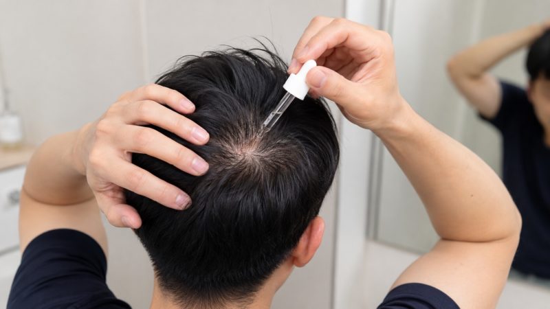 発毛成分を地肌へ浸透させる正しい塗り方。スポイトを使い、薄毛が気になる部分をピンポイントでケアする様子。
