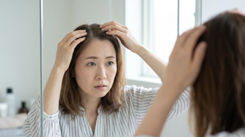 女性用育毛剤の効果的な使い方。分け目を変えて地肌の状態を詳しく確認する様子。